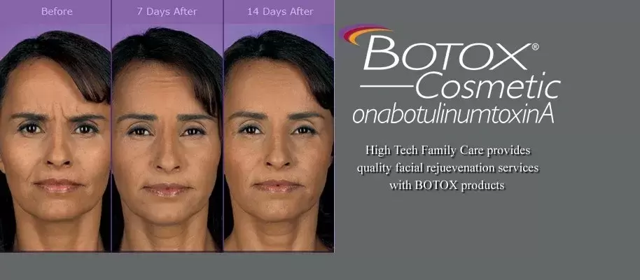 botox-cosmetic_orig
